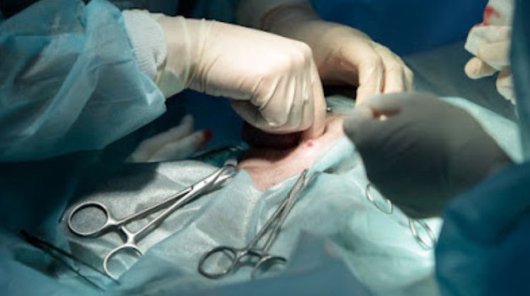 C-Section Complications